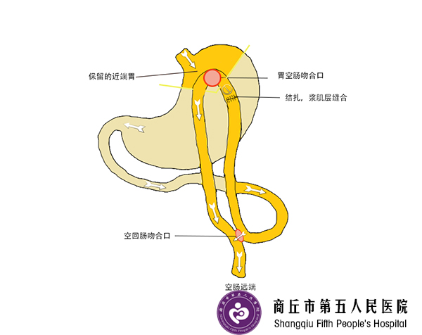 中原减重降糖中心：肥胖会导致三高吗